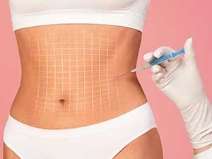 Lipo Injection